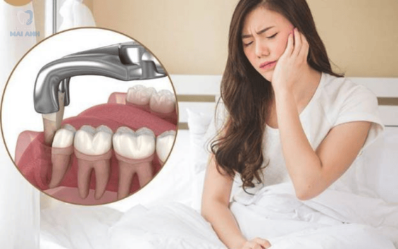 Bác sĩ Mai Phương - Bác sĩ nhổ răng khôn không đau tại Gò Vấp Bác sĩ Mai Phương - Bác sĩ nhổ răng khôn không đau tại Gò Vấp