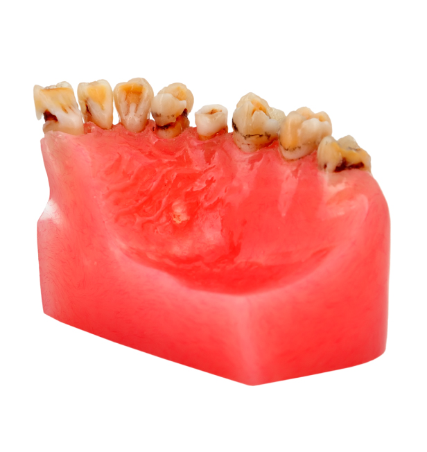 Các bệnh lý răng miệng thường gặp và nguyên nhân  Các bệnh lý răng miệng thường gặp và nguyên nhân