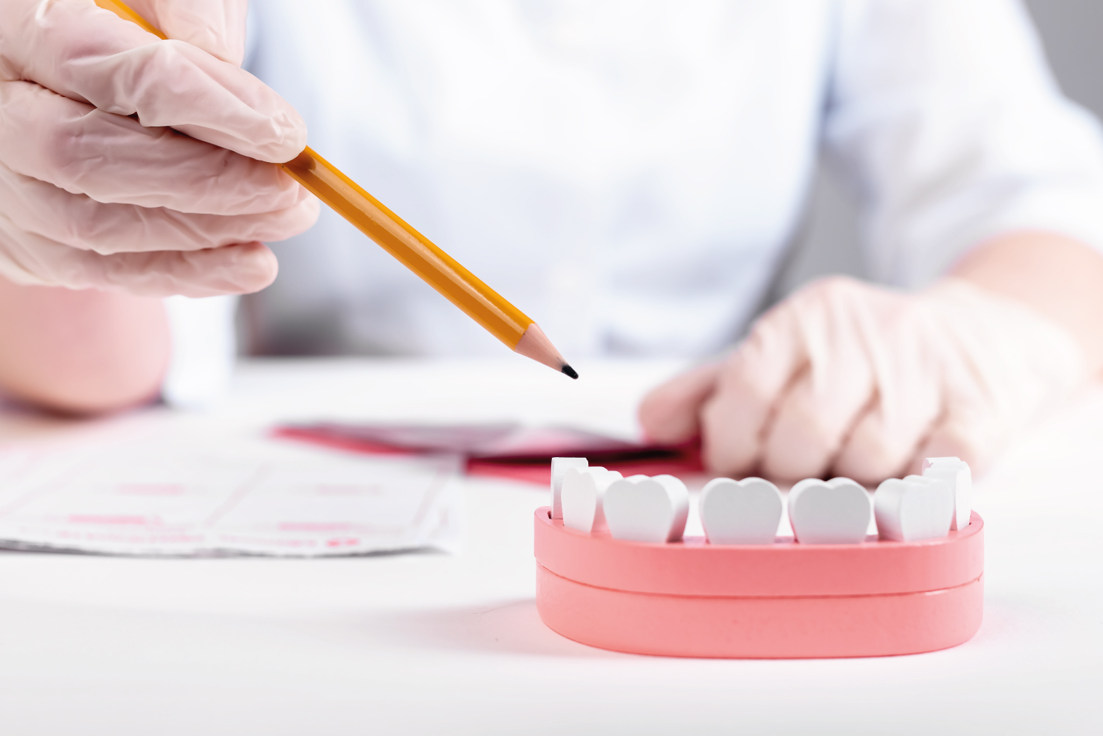 Lưu ý khi dán mặt sứ Veneer Lưu ý khi dán mặt sứ Veneer