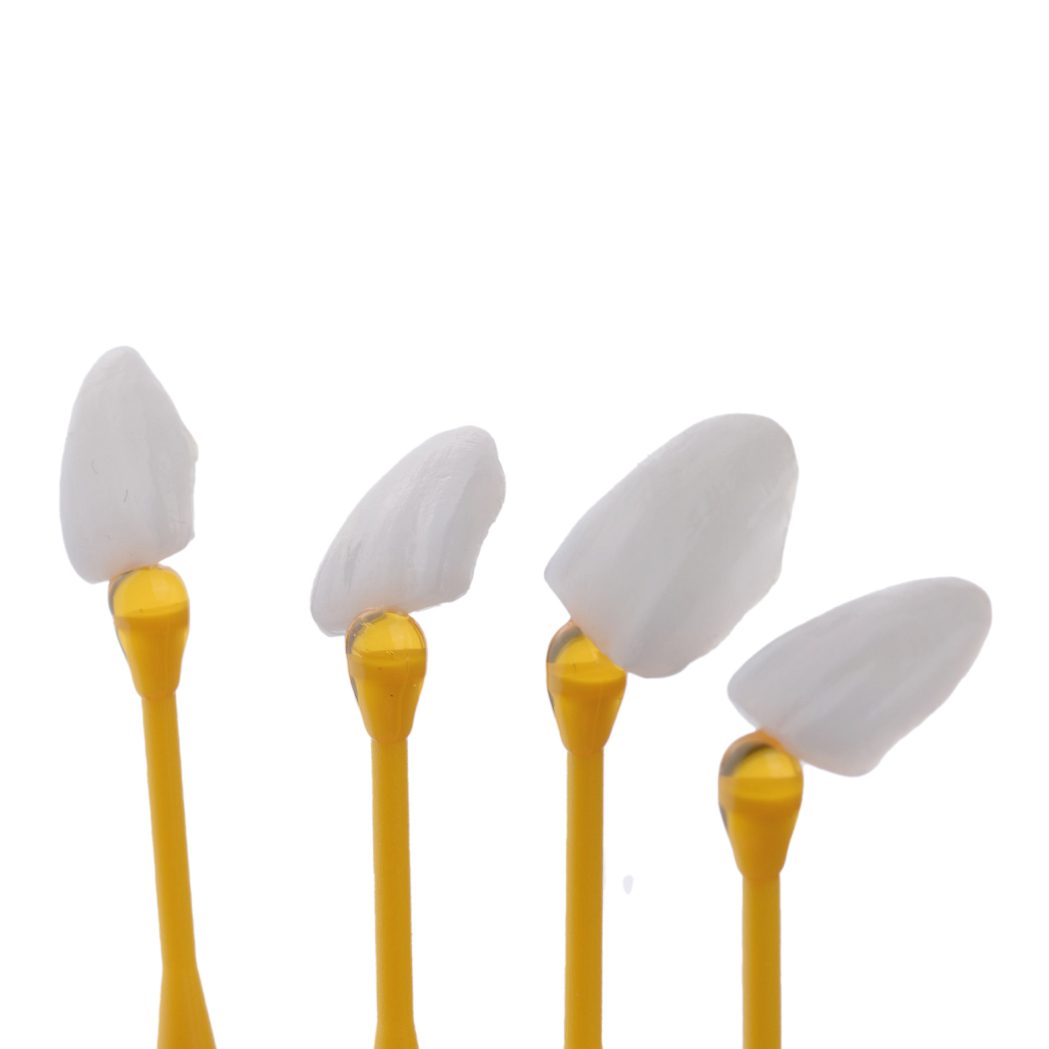 Mặt sứ Veneer có bao nhiêu loại? Mặt sứ Veneer có bao nhiêu loại?