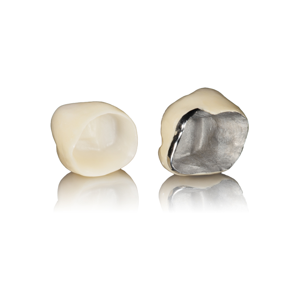 Răng sứ có bao nhiêu loại? Răng sứ có bao nhiêu loại?