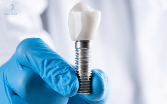 Làm răng giả bao nhiêu tiền? Lựa chọn tối ưu cho người lớn tuổi tại nha khoa Mai Anh