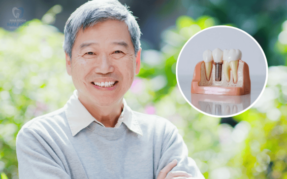 Cấy ghép Implant giá bao nhiêu? Tìm hiểu chi phí và lựa chọn cơ sở uy tín