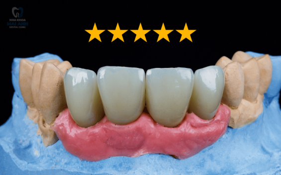 Giá trồng răng sứ trọn gói tại quận Gò Vấp mới nhất 2025