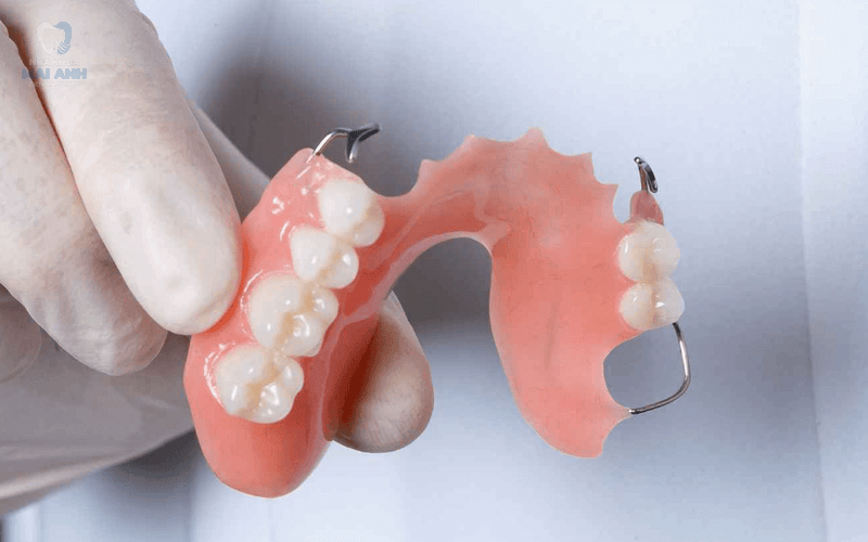 Trồng răng giả giá bao nhiêu? Bảng giá trồng răng giả mới nhất 2025 Trồng răng giả giá bao nhiêu? Bảng giá trồng răng giả mới nhất 2025