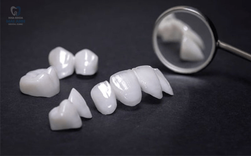 Làm răng implant toàn hàm - giải pháp khôi phục nụ cười vững bền tại nha khoa Mai Anh Làm răng implant toàn hàm - giải pháp khôi phục nụ cười vững bền tại nha khoa Mai Anh