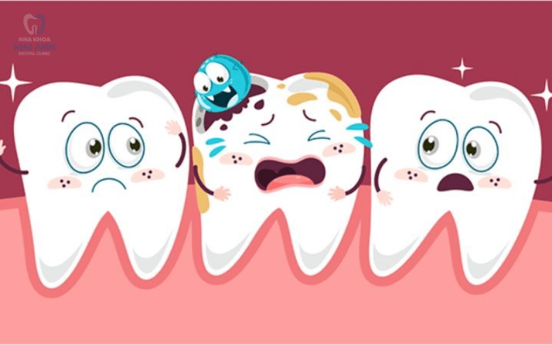 Hậu quả mất răng hàm có nghiêm trọng không? Hậu quả mất răng hàm có nghiêm trọng không?