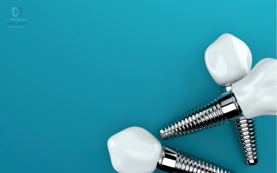 Nha khoa Mai Anh - Địa điểm trồng răng Implant tại Gò Vấp chất lượng