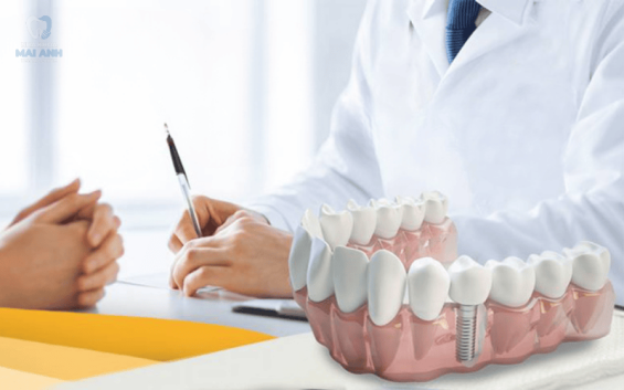 Trồng răng giá bao nhiêu? nên chọn phương pháp trồng răng nào?