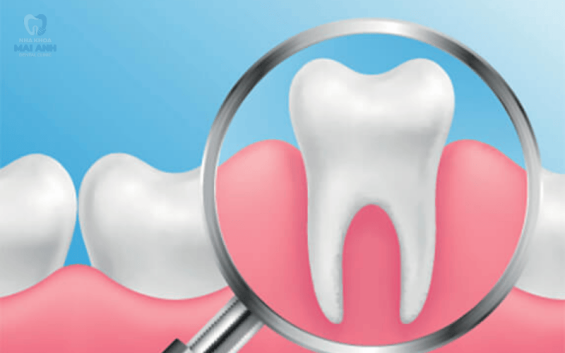 Hậu quả mất răng hàm có nghiêm trọng không?